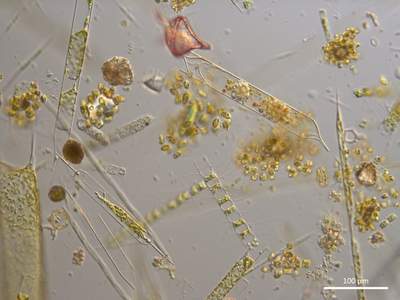Phyloplankton